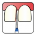 Osung Crown Anterior/ Proximal Cutting, Lingual Reduction Straight FG Shank 164-16F1 (160TC-11F) Fine Grit Diamond Bur 5/PK